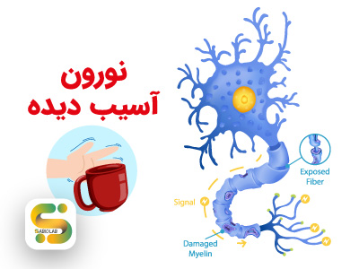 نورون آسیب دیده