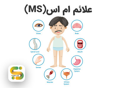 علائم بیماری ام‌ اس