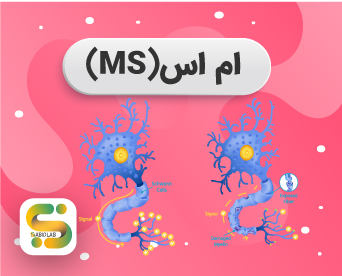 بیماری ام اس (ms) چیست؟ علائم و انواع آن