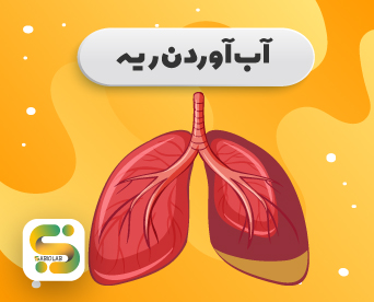 آب آوردن ریه یا پلورال افیوژنPleural Effusion(PE)